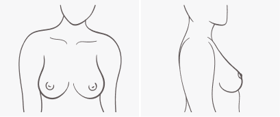 Side Set Breasts - Boob Shapes, HD Png Download - kindpng